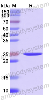 Recombinant Human BCL11A Protein, N-His