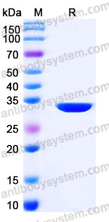 Recombinant Human CA13 Protein, C-His