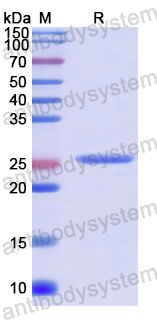 Recombinant Human DOHH Protein, N-His
