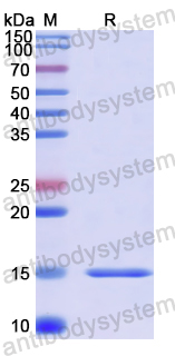 Recombinant Human NEUROG3 Protein, N-His