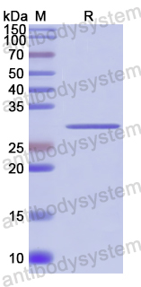 Recombinant Human OSGIN1 Protein, N-His