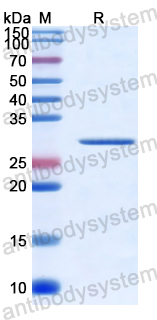 Recombinant Human FBXW7 Protein, N-His