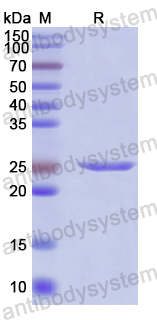 Recombinant Human CENPJ Protein, N-His