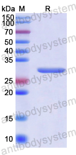 Recombinant Human B4GALNT2 Protein, N-His