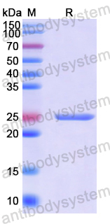 Recombinant Human BCO1 Protein, N-His