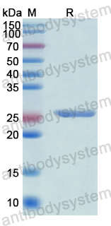 Recombinant Human SFTPA1 Protein, N-His