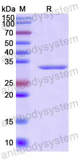 Recombinant Human ELMO1 Protein, N-His
