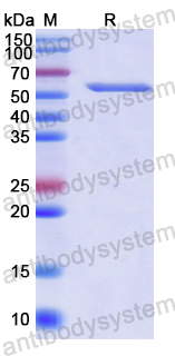 Recombinant Human EIF2AK3 Protein, N-His