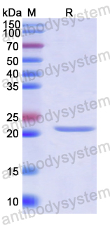 Recombinant Human CPT1B Protein, N-His