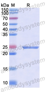 Recombinant Human CDH23 Protein, N-His