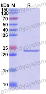 Recombinant Human BCL2L2 Protein, N-His