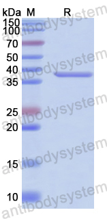 Recombinant Human ATP5IF1 Protein, N-GST