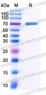 Recombinant Human SERPINA12 Protein, N-GST