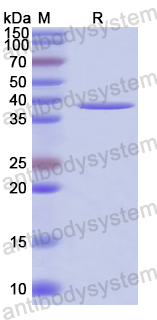 SDS-PAGE for Recombinant Human FETUB Protein, N-GST ?>
