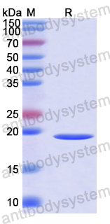 SDS-PAGE for Recombinant Human TMX2 Protein, N-His ?>