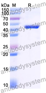 Recombinant Human SCARB1/SR-BI/CLA-1/SRB1 Protein, N-His
