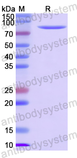 Recombinant Mouse YTHDF2/HGRG8 Protein, N-GST