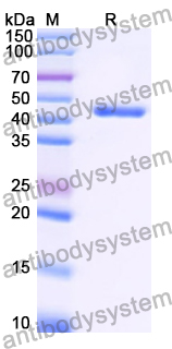 Recombinant Mouse YTHDF2/HGRG8 Protein, N-GST