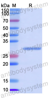 Recombinant Human INTS3/SOSS-A Protein, C-His