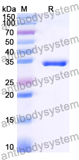 Recombinant Human MYOM3/Myomesin-3 Protein, N-His