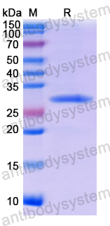 Recombinant Human TRPV6/ECaC2 Protein, N-His