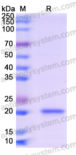 Recombinant Human TRBC1 Protein, N-His