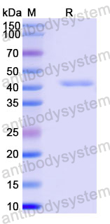 Recombinant Human TENT4A/PAPD7/TRF4 Protein, N-His