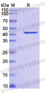 Recombinant Human SETD7 Protein, N-His