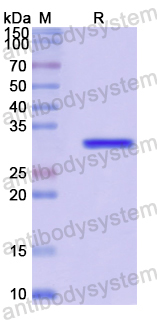 Recombinant Human SIRT5 Protein, N-His