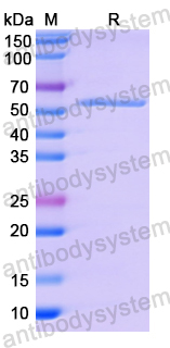 Recombinant Human SMYD3 Protein, N-His