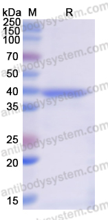 Recombinant Human KDM4D Protein, N-His