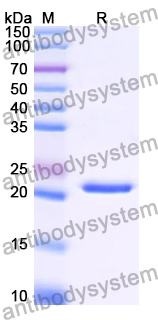 Recombinant Human PTP4A1/PRL1 Protein, N-His