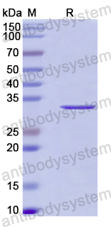 Recombinant Human CAGE1/CTAG3 Protein, N-His