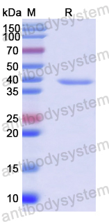 Recombinant Human DGCR8 Protein, N-His