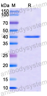 Recombinant Human OPTN Protein, N-GST & C-His