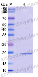 Recombinant Human RB1CC1 Protein, N-His
