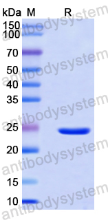 Recombinant Human PALLD Protein, N-His-SUMO & C-Strep