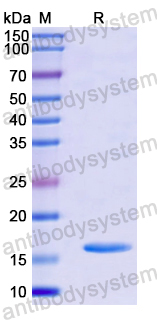 Recombinant Human IFT20 Protein, N-His