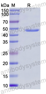 Recombinant Human IFT140 Protein, N-His