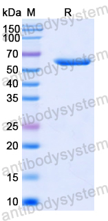 Recombinant Human SAMHD1 Protein, N-His