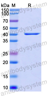 Recombinant Human MIEF1 Protein, N-His