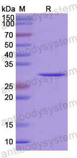 Recombinant Human CNOT1 Protein, N-His