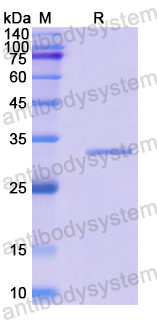 Recombinant Human SIRT3 Protein, N-His