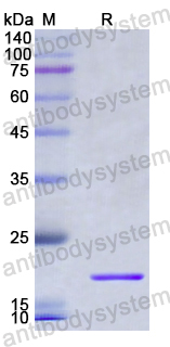 Recombinant Human STOML2 Protein, N-His