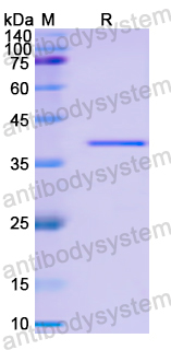 Recombinant Human MIEF2 Protein, N-His