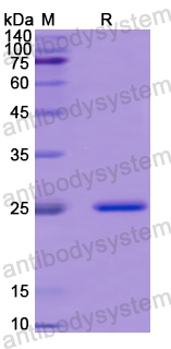 Recombinant Human TRIM63 Protein, N-His-SUMO & C-Strep