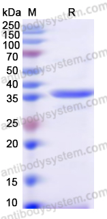 Recombinant Human DCAF1 Protein, N-His