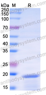 Recombinant Human IFT81 Protein, N-His