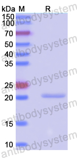 Recombinant Human HEY2 Protein, N-His-SUMO & C-Strep