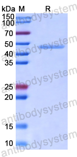 Recombinant Human KDM3A Protein, N-His